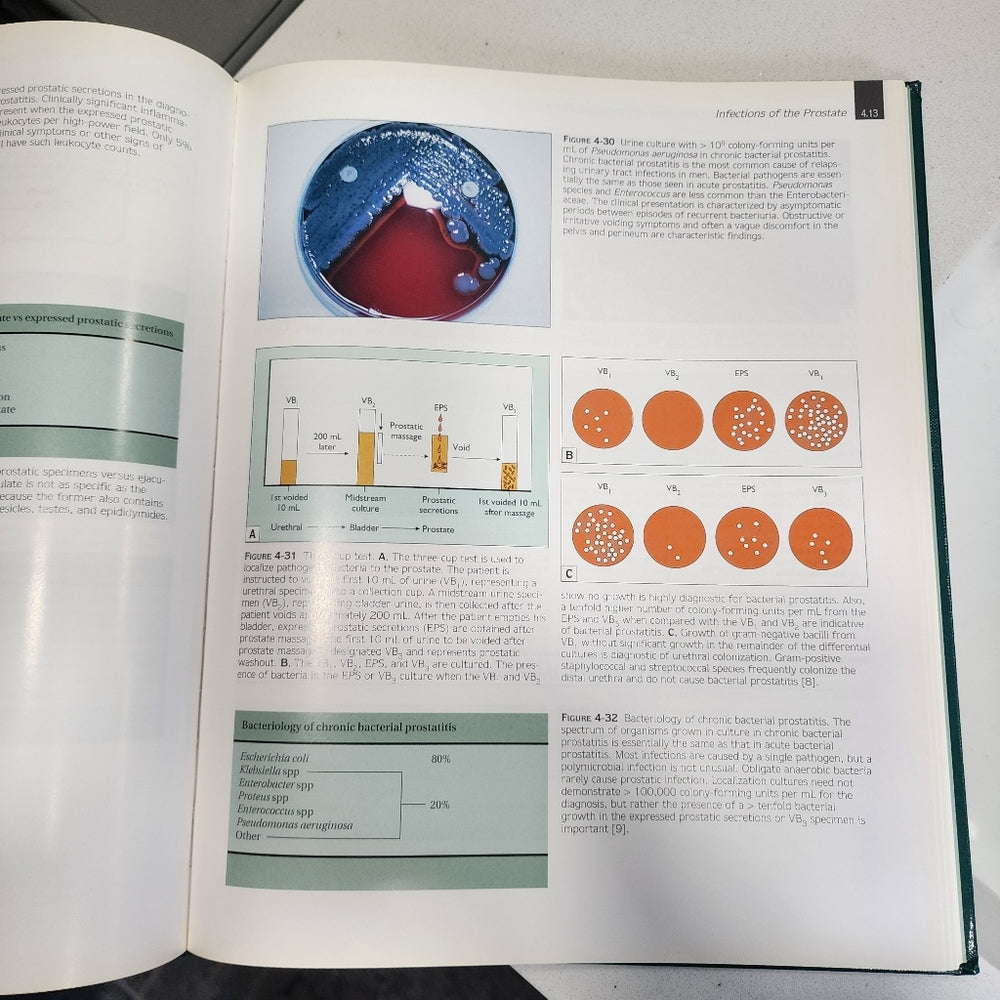 Book Atlas of infectious diseases urinary tract and female pelvis volume 9 1X