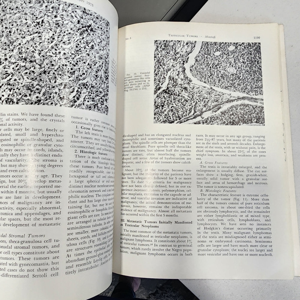 Book proceedings of the National Conference on Urologic cancer 1973